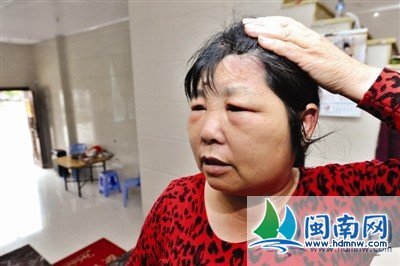 <em>染发</em>之后<em>洗头发</em>或者流汗会对头皮有伤害吗?-经