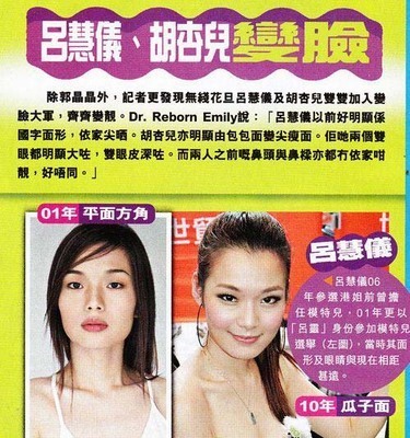 传郭晶晶为讨男友欢心整容 饼脸变尖眼变大【图】