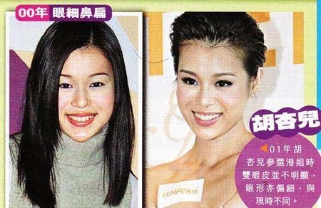 传郭晶晶为讨男友欢心整容 饼脸变尖眼变大【图】