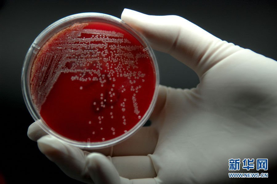 高清组图:探访中国超级细菌实验室