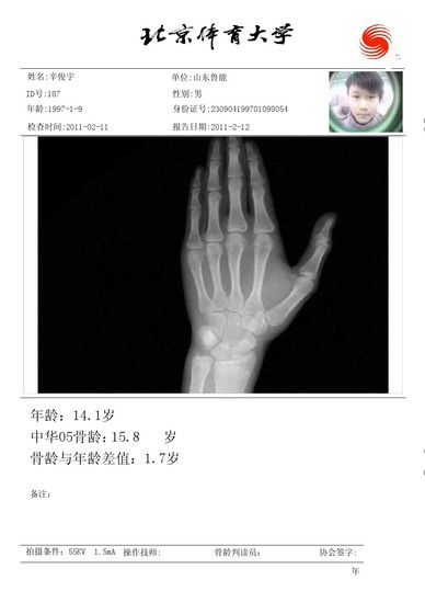 啥时候可以测骨龄 1602328_550x550_0.jpg