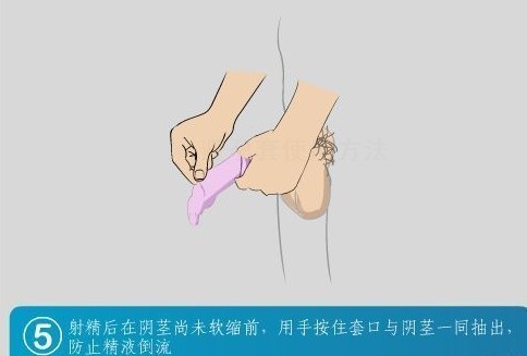 图解:避孕套使用方法_健康_腾讯·大渝网