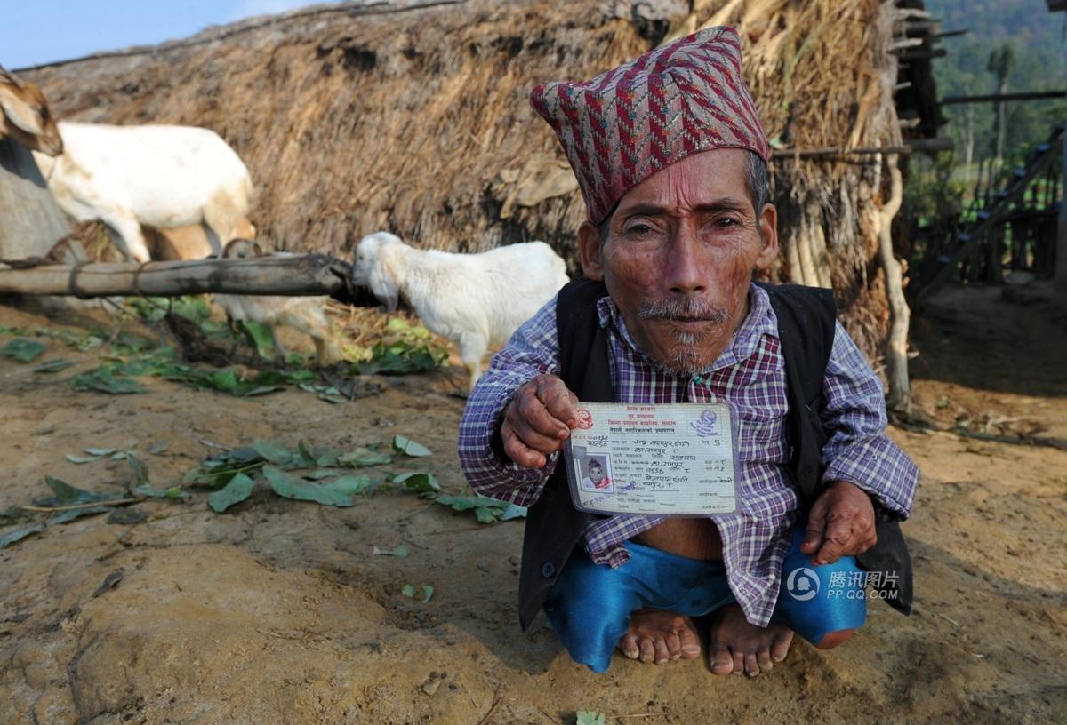 世界上最矮成人男子去世 享年75岁(高清组图)