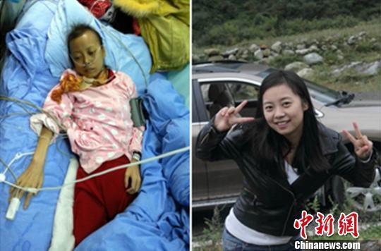 子患怪病暴瘦至40斤,一个月只喝水瘦了40斤,赵