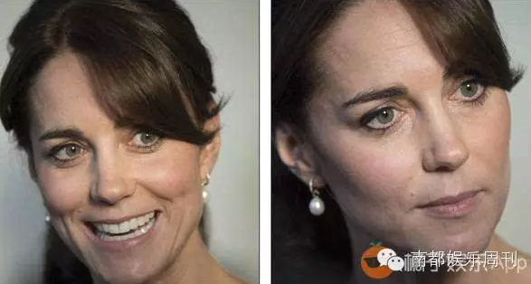 凯特王妃暴瘦成纸片人?细数患厌食症暴瘦女星(图)