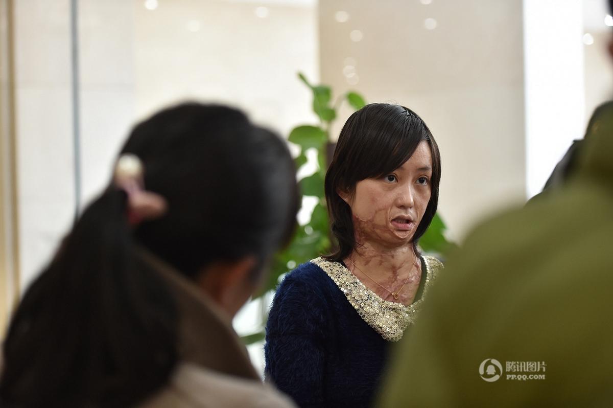 合肥少女毁容案二审开庭 周岩情绪激动