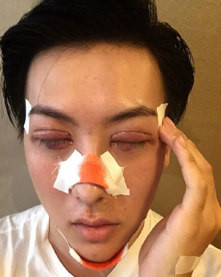 整容连性别都整变了?"蛇精男"成"蛇精女"