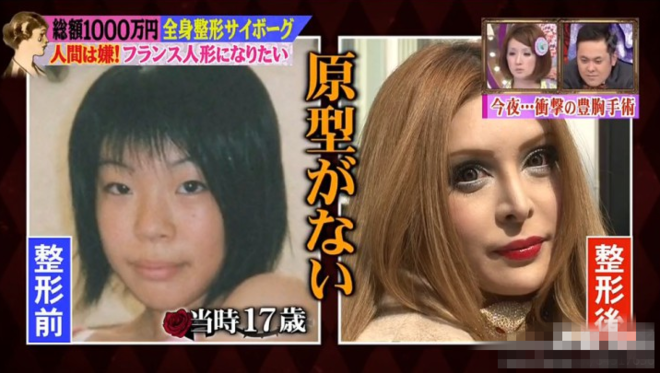 日女星整形50次还想动刀:技术跟不上我的计划(图)