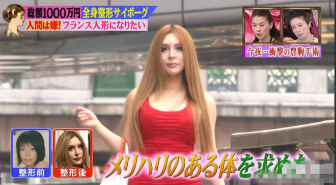 日女星整形50次还想动刀:技术跟不上我的计划(图)