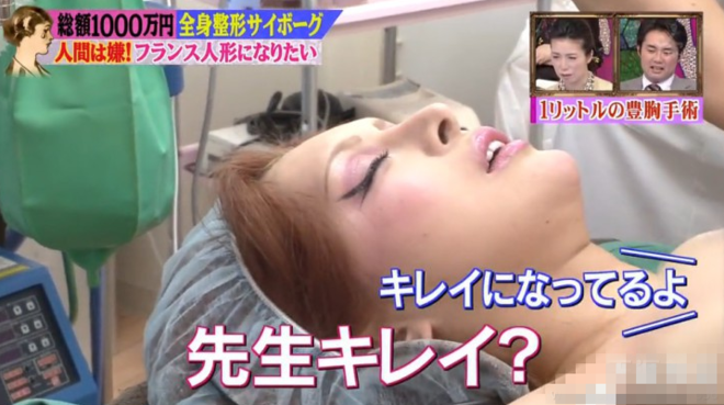 日女星整形50次还想动刀:技术跟不上我的计划(图)