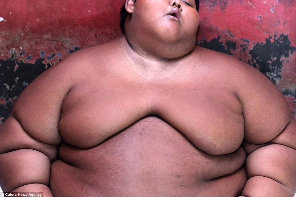 世界上最胖的_世界上最胖的小孩