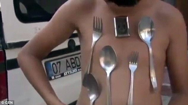 土耳其9岁男童成“小万磁王”自称身体能吸附金属