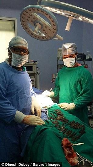 印度男子两个月吞40枚刀片 称迷恋这味道(组图)