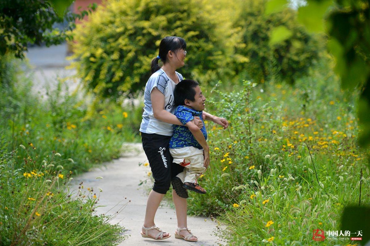 相依为命：袖珍男孩和烧伤女孩的爱情(高清组图)