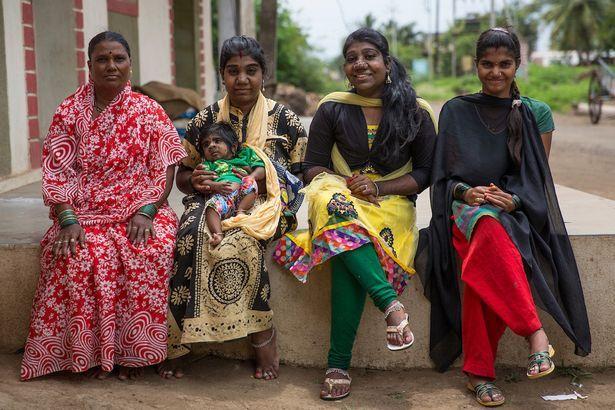 印度5月大男宝继承家族"狼人"基因 浑身是毛(图)