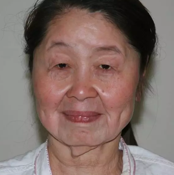 妙龄少女一夜变老如80岁 离家出走丈夫泪寻(组图)