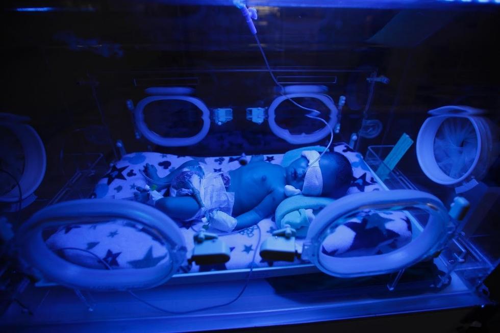 也门遭遇严重饥荒 全国一半人吃不饱饭(高清组图)