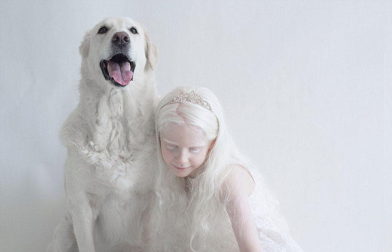 俄罗斯摄影师拍白化病人美似天使