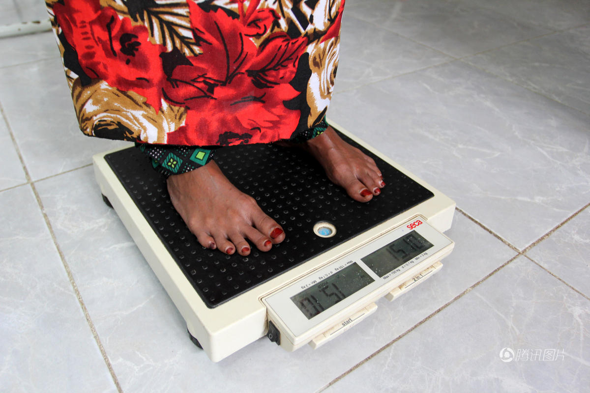 18岁少女营养不良瘦成干尸状 被救治后恢复容颜