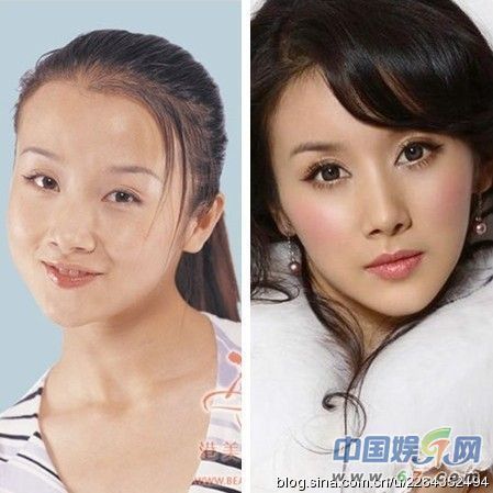 整容过度的明星,整容过度会怎样