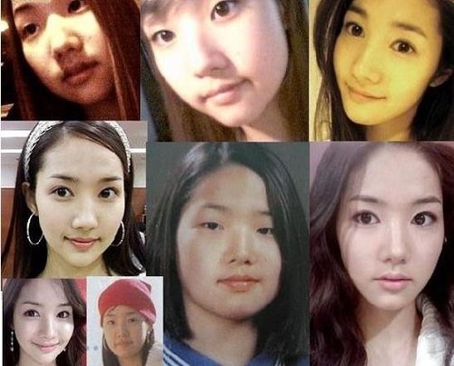 明星整容前后照片,明星整容前后照片图片