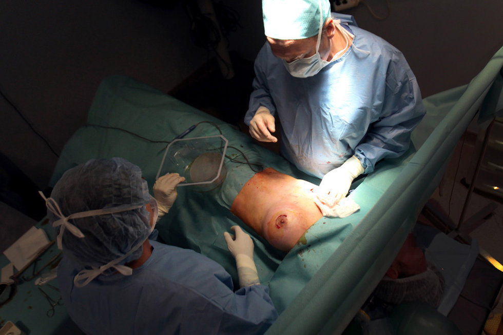 劣质硅胶威胁+-+贵州地方