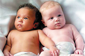 组图:令人称奇的“黑白双胞胎”_腾讯儿童_腾讯网