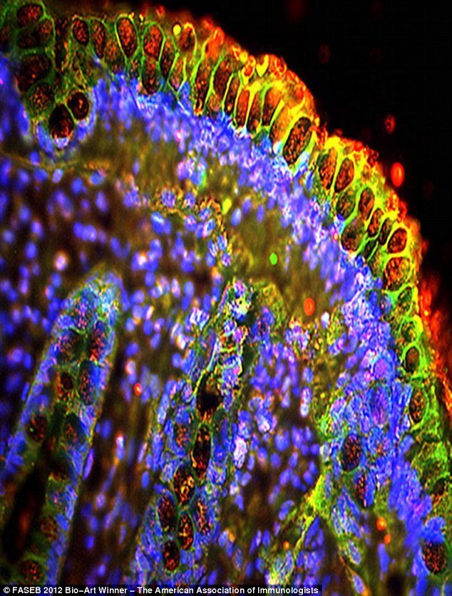 漂亮的微观图像:如图这是结肠组织,染色部化突显细胞的成份