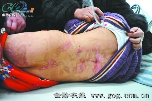 什么是身体虐待 5847296_1200x1000_0.jpg