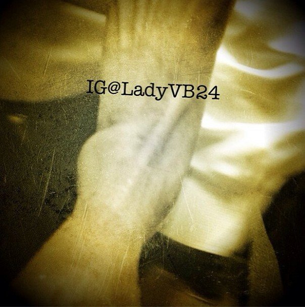 组图:瓦妮莎推特晒科比伤情 脚踝肿胀严重-的伤