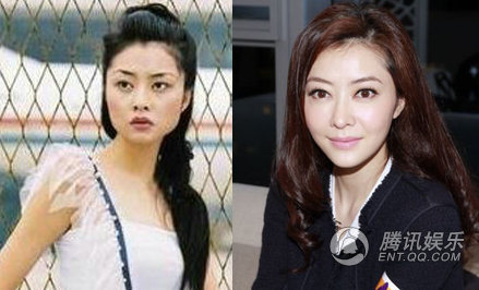 整容前后的照片更是铁证