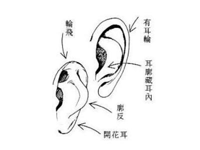面相一:耳廓凸出于耳轮外
