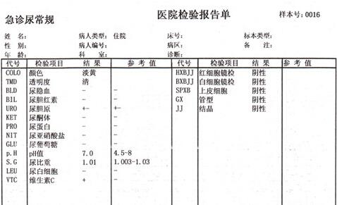 问:如果明天要尿常规检查,我今晚一晚上不睡觉对明天的尿常规检查会有