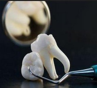 专家揭秘拔牙,你不知道的事; 大燕口腔讲堂_大