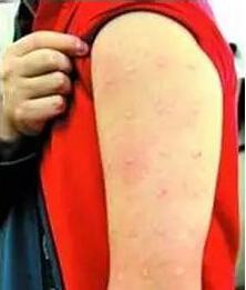 恶性杂草三裂叶豚草再现密云