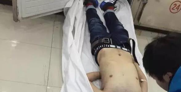 江苏大学研究生和导师聚餐后猝死,原因何在?