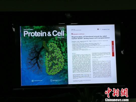 同济大学研究团队实现全球首例人类肺脏再生