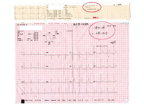 南充小伙公招体检后续:华西体检结论仍正常