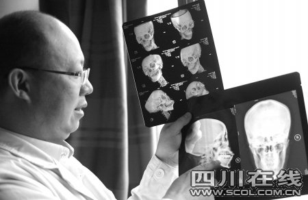 女子金丝美容后皮肤红肿 医生称易致面瘫_热