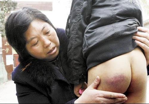 小学生不会背课文被老师用铁棍<em>打屁股</em>(组图)_