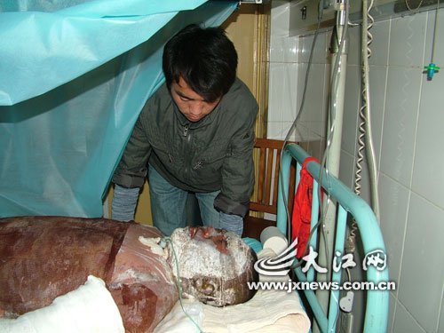 翁婿3闯火海救6人被烧伤 女婿仅脚底完好(图)