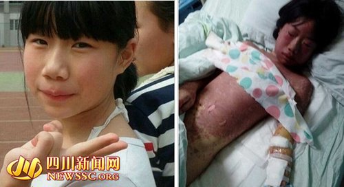 麻辣社区网友救助南充重病<em>小女孩</em>璐琪 募捐超