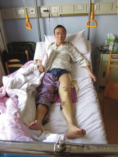 3小贼租来轿车偷电瓶车遭发现 飞车撞翻车主