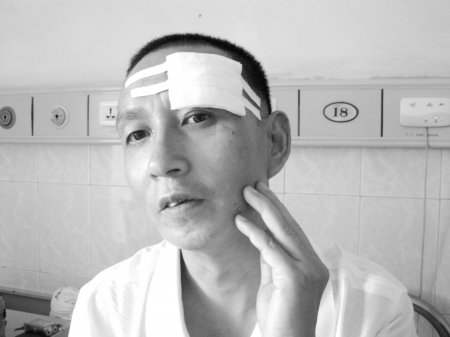 狗狗打架主人抄起砖头参战 其中一人头部受伤