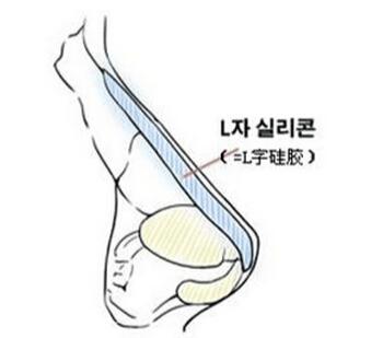 这招教你辨别朋友是否隆鼻 赶快get起来