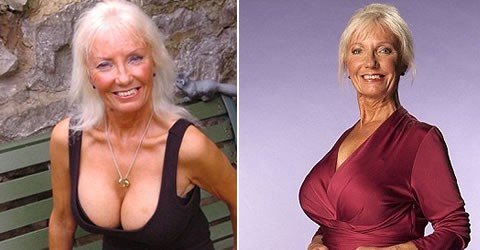 英65岁老妇隆胸变F罩杯 开始约会24岁壮男(图)