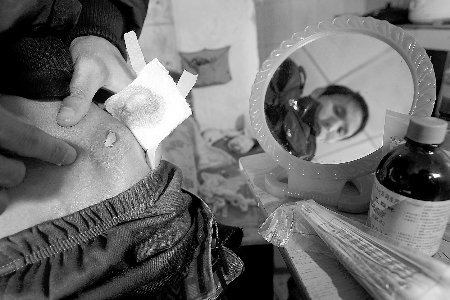 患者手术后伤口出现纱布 医院称是新纱布(图)