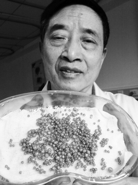 一旦发现胆结石