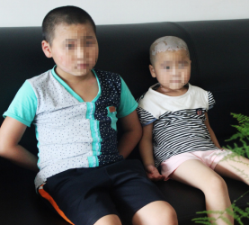 儿童白癜风怎么治能好