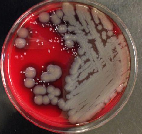专家告诉你:姑娘们的<em>胸罩有多脏</em>_大成网_腾讯